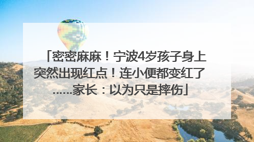 密密麻麻！宁波4岁孩子身上突然出现红点！连小便都变红了……家长：以为只是摔伤
